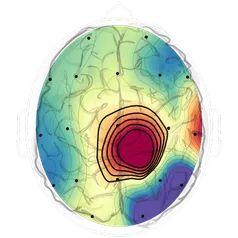 BrainMaps info brainboost