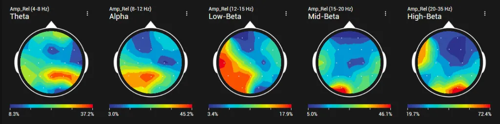 Example of a BrainMap: brain activity in the theta, alpha, low beta, mid beta and high beta frequency bands