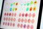 EEG - quantitative EEG